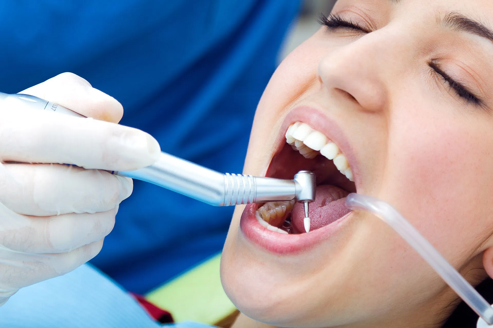 Paciente durante una limpieza dental profesional en la consulta